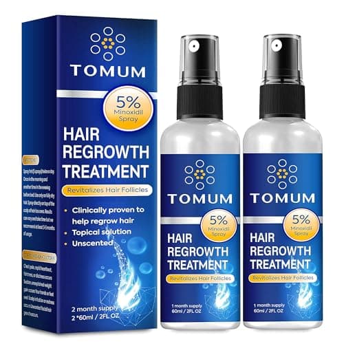 What is hair loss stages explained Norwood? A Complete 2026 Guide